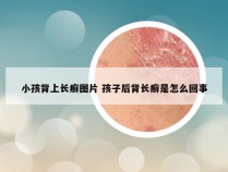 小孩背上长癣图片 孩子后背长癣是怎么回事