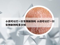 小孩可以打一针生物制剂吗 小孩可以打一针生物制剂吗多少钱