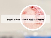 膝盖长了癣擦什么软膏 膝盖处长癣很痒