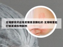 无锡那家药店有卖银屑录颗粒的 无锡哪里能打银屑病生物制剂