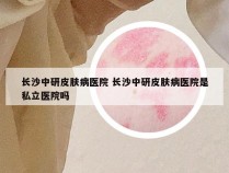 长沙中研皮肤病医院 长沙中研皮肤病医院是私立医院吗