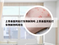 上蔡县医院能打生物制剂吗 上蔡县医院能打生物制剂吗现在