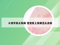 小宝贝背止有癣 宝宝背上有癣怎么去除