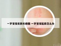 一岁宝宝皮肤长癣图 一岁宝宝起藓怎么办