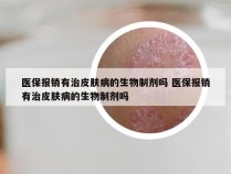 医保报销有治皮肤病的生物制剂吗 医保报销有治皮肤病的生物制剂吗