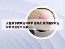 女童腋下前胸后背有白色斑点 孩子腋窝附近有白斑是怎么回事