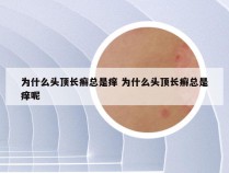 为什么头顶长癣总是痒 为什么头顶长癣总是痒呢