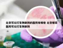 北京可以打生物制剂的医院有哪些 北京哪家医院可以打生物制剂