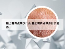 腿上有白点缺少什么 腿上有白点缺少什么营养