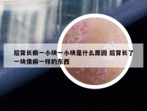 后背长癣一小块一小块是什么原因 后背长了一块像癣一样的东西