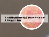 生物制剂需要做什么检查 使用生物制剂需要定期复查什么指标