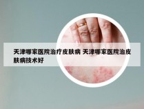 天津哪家医院治疗皮肤病 天津哪家医院治皮肤病技术好