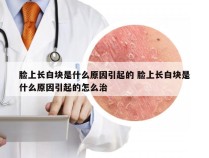 脸上长白块是什么原因引起的 脸上长白块是什么原因引起的怎么治