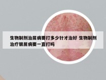 生物制剂治屑病要打多少针才治好 生物制剂治疗银屑病要一直打吗