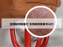 生物制剂哪里打 生物制剂那里可以打