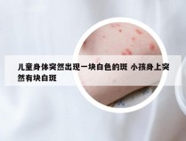 儿童身体突然出现一块白色的斑 小孩身上突然有块白斑