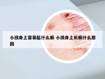 小孩身上容易起什么癣 小孩身上长癣什么原因