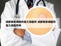 成都银屑病医院是几级医院 成都银屑病医院是几级医院啊