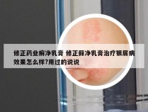 修正药业癣净乳膏 修正藓净乳膏治疗银屑病效果怎么样?用过的说说