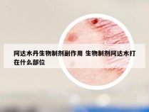 阿达木丹生物制剂副作用 生物制剂阿达木打在什么部位