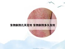 生物制剂几天见效 生物制剂多久生效