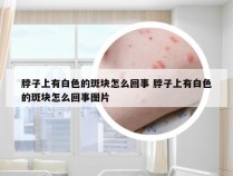 脖子上有白色的斑块怎么回事 脖子上有白色的斑块怎么回事图片