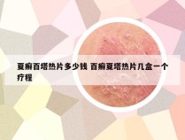 夏癣百塔热片多少钱 百癣夏塔热片几盒一个疗程