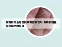 生物制剂治疗皮肤病有依赖性吗 生物制剂在皮肤病中的应用