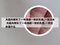 大腿内侧长了一块像癣一样的东西,一挠流水 大腿内侧长了一块像癣一样的东西,一挠流水是什么