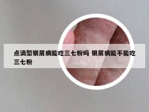 点滴型银屑病能吃三七粉吗 银屑病能不能吃三七粉