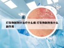 打生物制剂针治疗什么病 打生物制剂有什么副作用