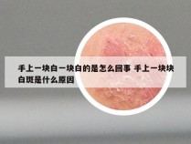 手上一块白一块白的是怎么回事 手上一块块白斑是什么原因