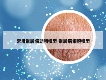 常用银屑病动物模型 银屑病细胞模型