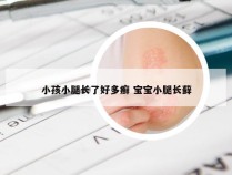 小孩小腿长了好多癣 宝宝小腿长藓