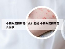 小孩头皮糠癣是什么引起的 小孩头皮糠疹怎么回事