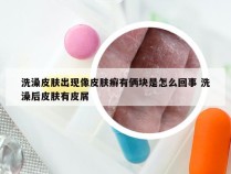 洗澡皮肤出现像皮肤癣有俩块是怎么回事 洗澡后皮肤有皮屑