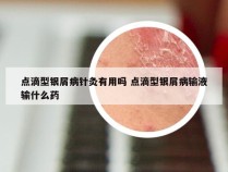 点滴型银屑病针灸有用吗 点滴型银屑病输液输什么药