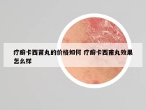 疗癣卡西莆丸的价格如何 疗癣卡西甫丸效果怎么样