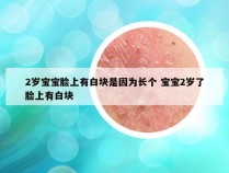 2岁宝宝脸上有白块是因为长个 宝宝2岁了脸上有白块