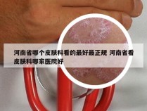 河南省哪个皮肤科看的最好最正规 河南省看皮肤科哪家医院好