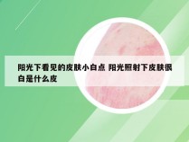 阳光下看见的皮肤小白点 阳光照射下皮肤很白是什么皮