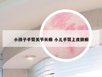 小孩子手臂关节长癣 小儿手臂上皮肤癣