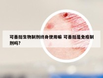 可善挺生物制剂终身使用嘛 可善挺是免疫制剂吗?