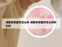 成都皮肤医院怎么样 成都皮肤医院怎么样好不好