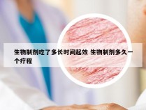 生物制剂吃了多长时间起效 生物制剂多久一个疗程