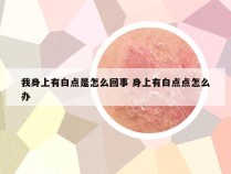 我身上有白点是怎么回事 身上有白点点怎么办