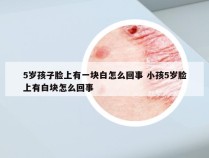 5岁孩子脸上有一块白怎么回事 小孩5岁脸上有白块怎么回事