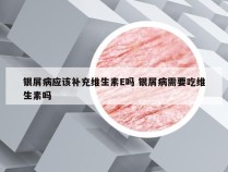 银屑病应该补充维生素E吗 银屑病需要吃维生素吗