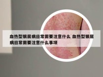 血热型银屑病日常需要注意什么 血热型银屑病日常需要注意什么事项