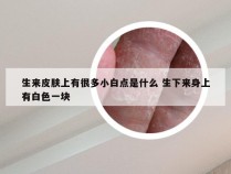 生来皮肤上有很多小白点是什么 生下来身上有白色一块